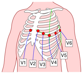 Файл:Precordial Leads 2.svg