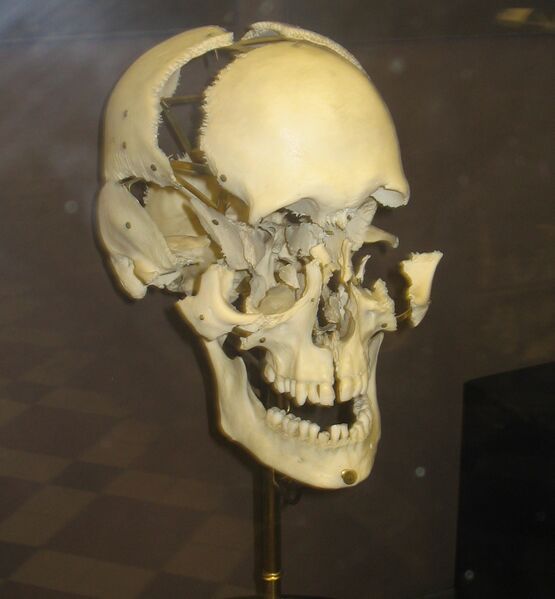 Файл:Exploded Human Skull.jpg