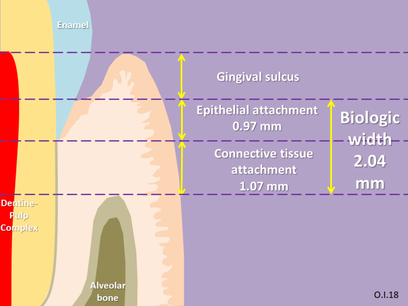 Файл:Biologic width (dentistry).png
