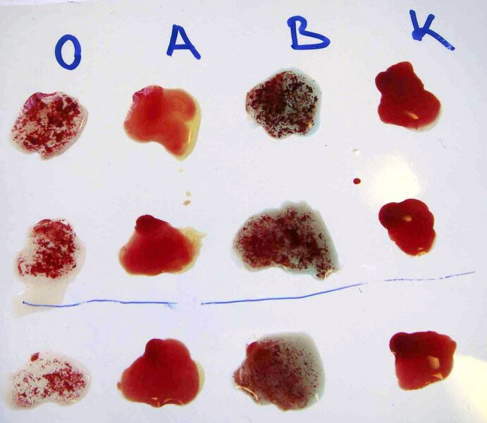 Файл:BlutAgglutination.JPG