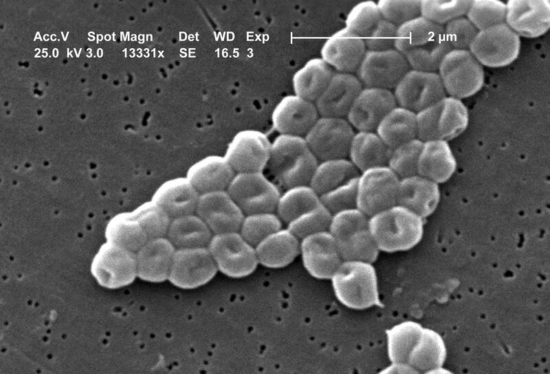 Файл:Acinetobacter baumannii.JPG