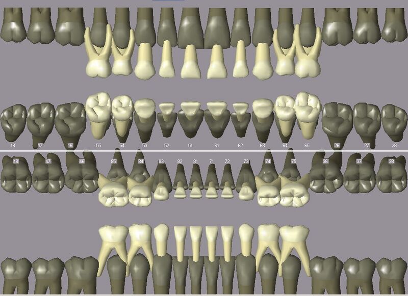 Файл:Primary dentition.jpg