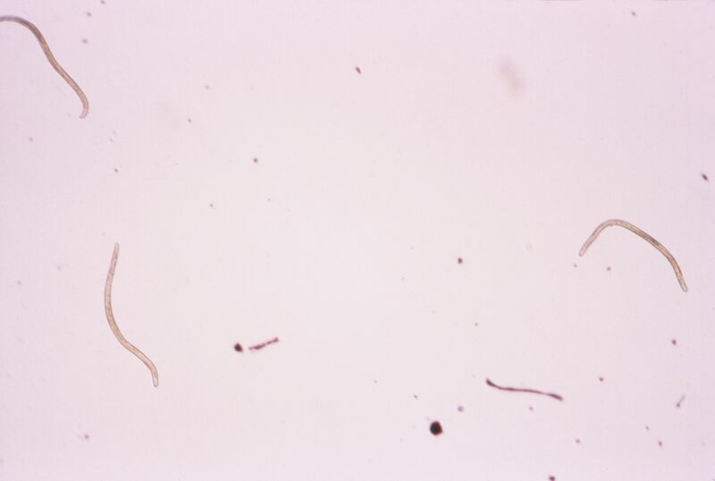 Файл:Onchocerca volvulus 01.jpg