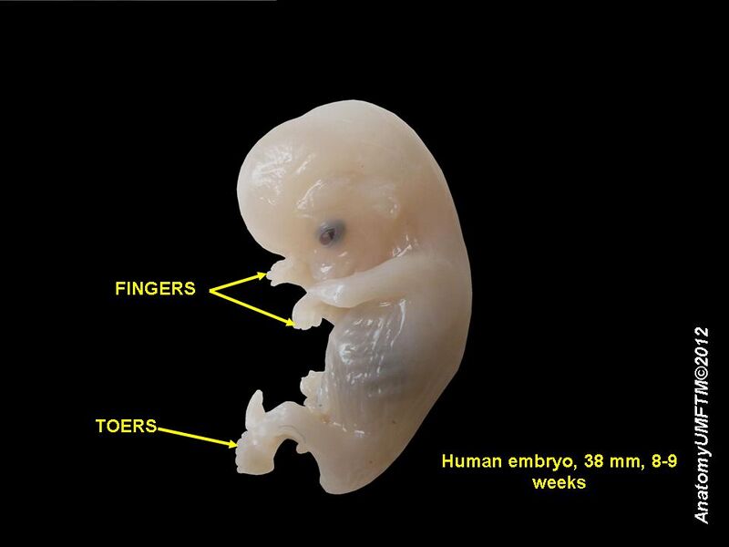 Файл:Human embryo 2.JPG