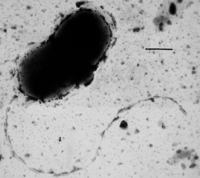 Файл:Dvulgaris micrograph.JPG