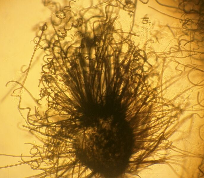 Файл:Microphoto Chaetomium globosum.jpg