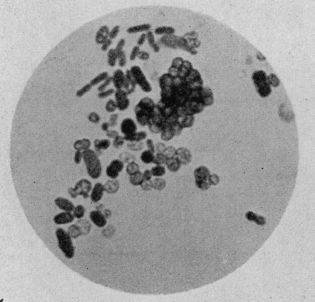 Файл:Azotobacter cells.jpg