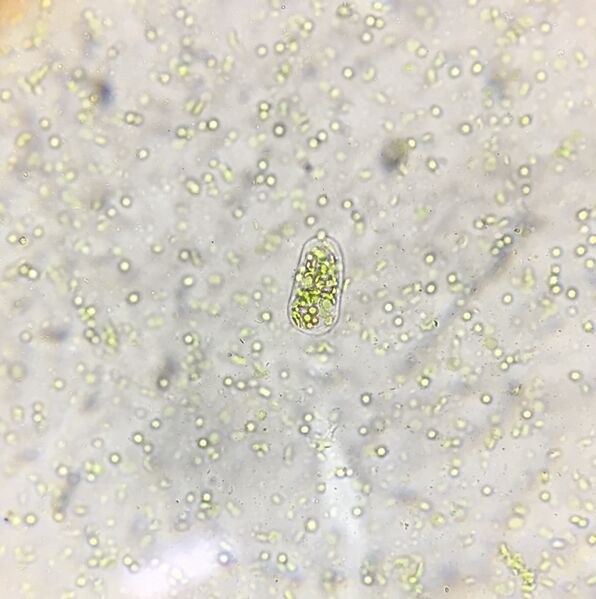 Файл:Chloroplast.jpeg