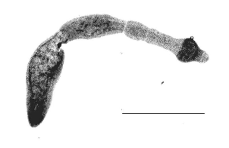 Файл:Echinococcus multilocularis.jpg