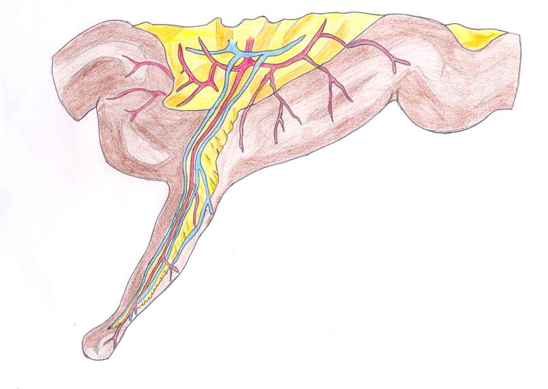 Файл:Diverticule de Meckel.jpg