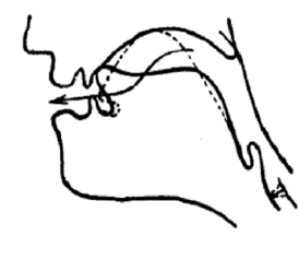 Стрелочкой обозначается прохождение воздуха между щёками и боками языка у страдающего боковым сигматизмом.