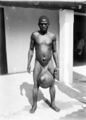 Африканец с генитальным элефантиазом, 1906 г.