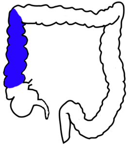Восходящая ободочная кишка обозначена синим