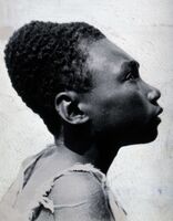 Мужчина с деформированным черепом. Остров Бугенвиль, Папуа — Новая Гвинея, около 1919 г.