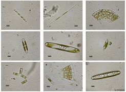 Несколько видов пресноводных диатомовых водорослей