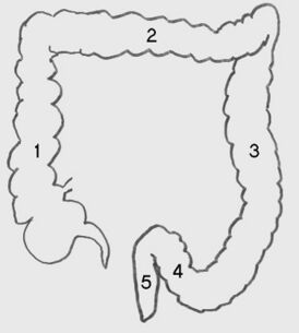 1 — слепая кишка с червеобразным отростком и восходящая ободочная кишка; 2 — поперечная ободочная кишка; 3 — нисходящая ободочная кишка; 4 — сигмовидная кишка; 5 — прямая кишка.