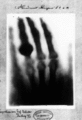 Отпечаток одного из первых рентгеновских снимков Вильгельма Рентгена (1845–1923) левой руки его жены Анны Берты Людвиг. Оно было вручено профессору Людвигу Цендеру из Физического института Фрайбургского университета 1 января 1896 года.