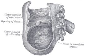 Вид изнутри на слепую кишку и нижнюю часть восходящей ободочной кишки и на илеоцекальный клапан (Баугиниеву заслонку), на рисунке обозначенный как «Colic valve» (старое название илеоцекального клапана). Рисунок из «Анатомии Грея»