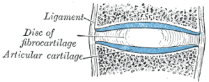 Схематическое изображение распила амфиартроза: синим цветом изображены суставные поверхности, между которыми расположен внутрисуставной хрящевой диск, по краям сочленение фиксируют короткие связки.