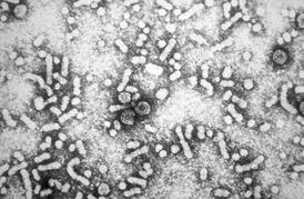 Электронная микрофотография вируса гепатита B