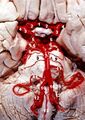 Кровоснабжение ствола головного мозга