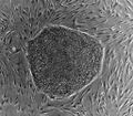 Колония эмбриональных стволовых клеток человека на фидерном слое фибробластов мыши