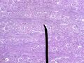 Микрофотография коркового слоя паренхимы почки