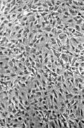 Нормальные NIH-3T3-клетки в клеточной культуре. Фотография сделана с помощью фазово-контрастного микроскопа, увел. в 100 раз.