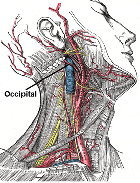 Поверхностное рассечение правой половины шеи. Видны сонные и подключичная артерии.