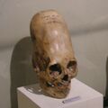 Деформированные черепа из музея Паракаса, Ика
