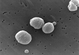 Клетки Streptococcus pneumoniae под электронным микроскопом